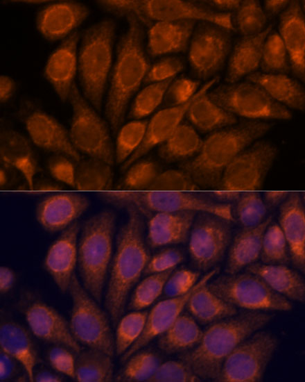 Immunofluorescence analysis of HeLa cells using IPO4 Polyclonal Antibody at dilution of  1:100. Blue: DAPI for nuclear staining.