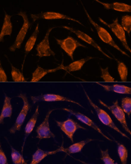 Immunofluorescence analysis of L929 cells using IPO4 Polyclonal Antibody at dilution of  1:100. Blue: DAPI for nuclear staining.