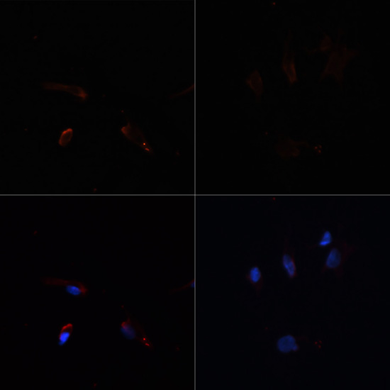 Immunofluorescence analysis of C6 cells using ACACA Polyclonal Antibody at dilution of  1:100. C6 cells were treated by Hydrogen Peroxide (2 nM) at 37℃ for 15 minutes after serum-starvation overnight(left). Blue: DAPI for nuclear staining.