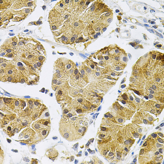Immunohistochemistry of paraffin-embedded Human stomach using NTRK1 Polyclonal Antibody at dilution of  1:100 (40x lens).