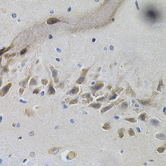 Immunohistochemistry of paraffin-embedded Mouse brain using NTRK1 Polyclonal Antibody at dilution of  1:100 (40x lens).