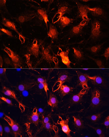 Immunofluorescence analysis of C6 cells using RNF149 Polyclonal Antibody at dilution of  1:100 (40x lens). Blue: DAPI for nuclear staining.