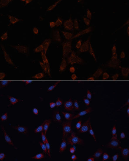 Immunofluorescence analysis of NIH/3T3 cells using CANX Polyclonal Antibody at dilution of  1:100. Blue: DAPI for nuclear staining.