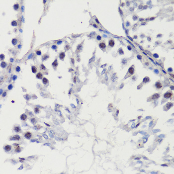 Immunohistochemistry of paraffin-embedded Rat testis using p27 KIP 1 Polyclonal Antibody at dilution of  1:100 (40x lens).