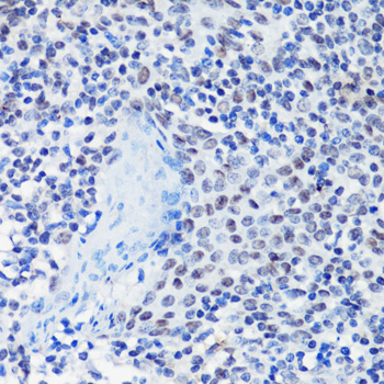 Immunohistochemistry of paraffin-embedded Human tonsil using p27 KIP 1 Polyclonal Antibody at dilution of  1:100 (40x lens).