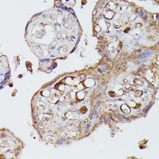 Immunohistochemistry of paraffin-embedded Human placenta using AGT Polyclonal Antibody at dilution of  1:100 (40x lens).