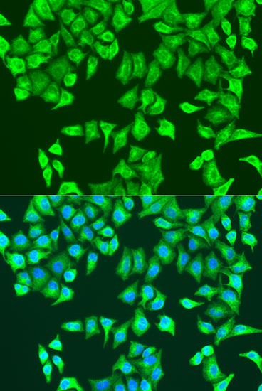 Immunofluorescence analysis of U2OS cells using RHOA Polyclonal Antibody at dilution of  1:100. Blue: DAPI for nuclear staining.
