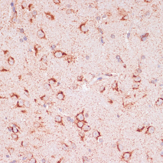 Immunohistochemistry of paraffin-embedded Rat brain using ENTPD6 Polyclonal Antibody at dilution of  1:100 (40x lens).