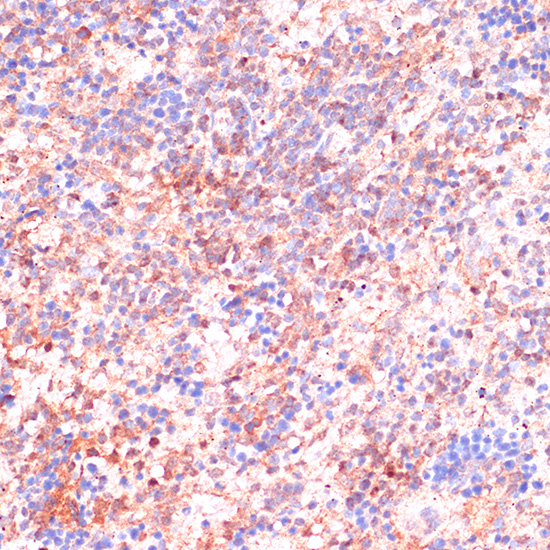 Immunohistochemistry of paraffin-embedded Rat spleen using CDC20 Polyclonal Antibody at dilution of  1:100 (40x lens).