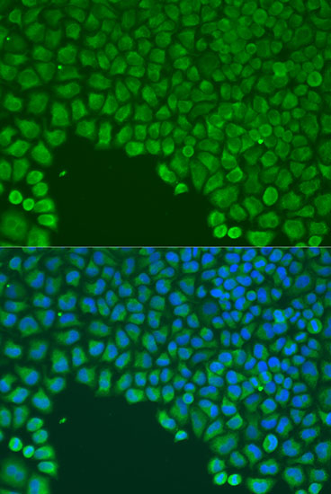 Immunofluorescence analysis of U2OS cells using CDC42 Polyclonal Antibody at dilution of  1:100. Blue: DAPI for nuclear staining.