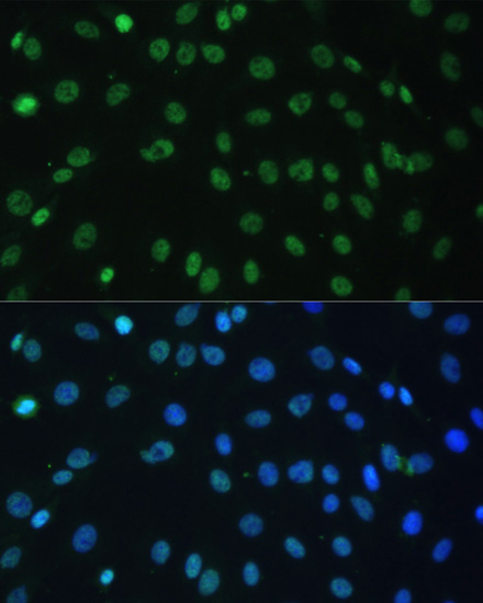 Immunofluorescence analysis of C6 cells using HNRNPD Polyclonal Antibody at dilution of  1:100. Blue: DAPI for nuclear staining.