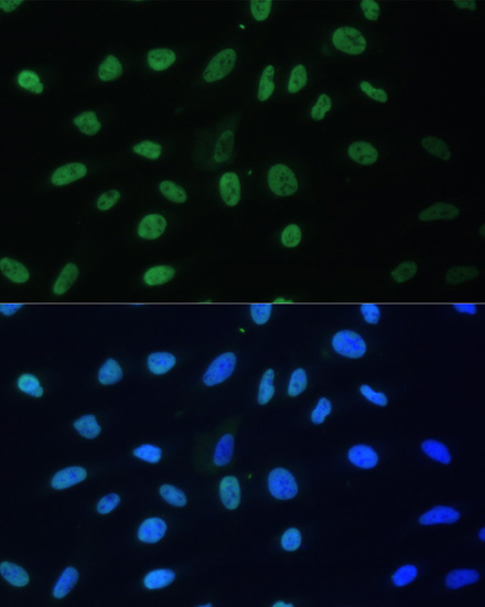 Immunofluorescence analysis of U-2 OS cells using HNRNPD Polyclonal Antibody at dilution of  1:100. Blue: DAPI for nuclear staining.