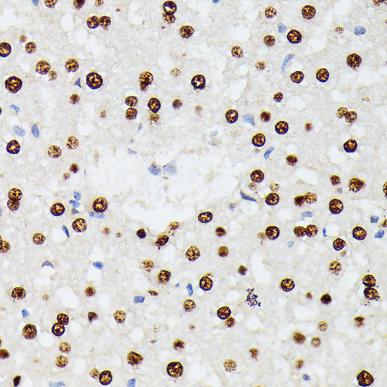 Immunohistochemistry of paraffin-embedded Rat liver using HNRNPD Polyclonal Antibody at dilution of  1:100 (40x lens).