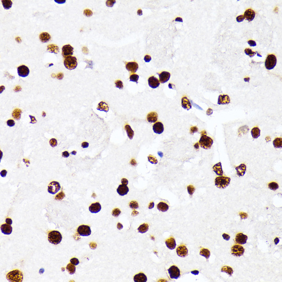 Immunohistochemistry of paraffin-embedded Mouse brain using HNRNPD Polyclonal Antibody at dilution of  1:100 (40x lens).