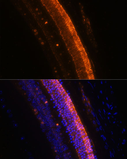 Immunofluorescence analysis of Mouse eye using KCNS2 Polyclonal Antibody at dilution of  1:100 (40x lens). Blue: DAPI for nuclear staining.