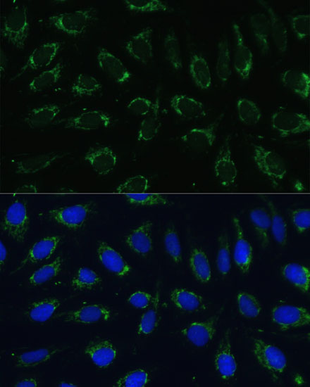 Immunofluorescence analysis of U-2 OS cells using NDUFA4 Polyclonal Antibody at dilution of  1:100 (40x lens). Blue: DAPI for nuclear staining.
