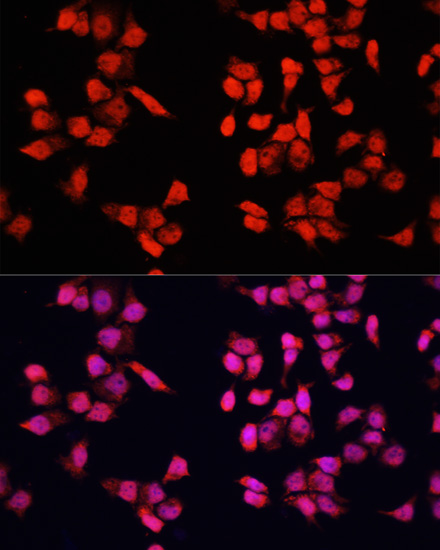 Immunofluorescence analysis of HeLa cells using YBX1 Polyclonal Antibody at dilution of  1:100. Blue: DAPI for nuclear staining.