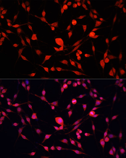 Immunofluorescence analysis of PC-12 cells using YBX1 Polyclonal Antibody at dilution of  1:100. Blue: DAPI for nuclear staining.