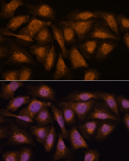 Immunofluorescence analysis of U-2 OS cells using PPP2R5D Polyclonal Antibody at dilution of  1:100. Blue: DAPI for nuclear staining.