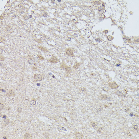 Immunohistochemistry of paraffin-embedded Rat brain using PPP2R5D Polyclonal Antibody at dilution of  1:100 (40x lens).
