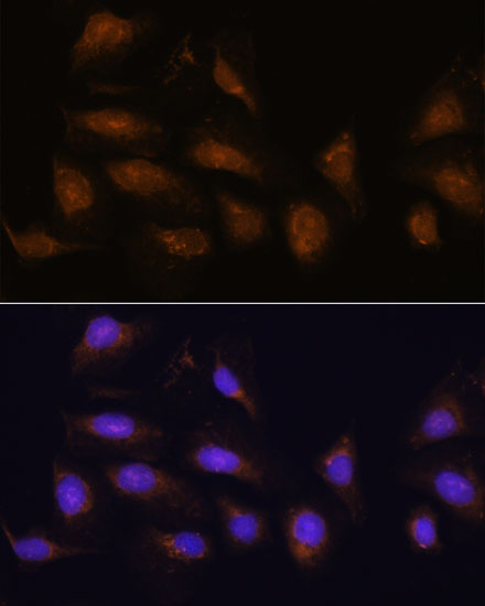 Immunofluorescence analysis of U-2 OS cells using P90RSK Polyclonal Antibody at dilution of  1:100. Blue: DAPI for nuclear staining.