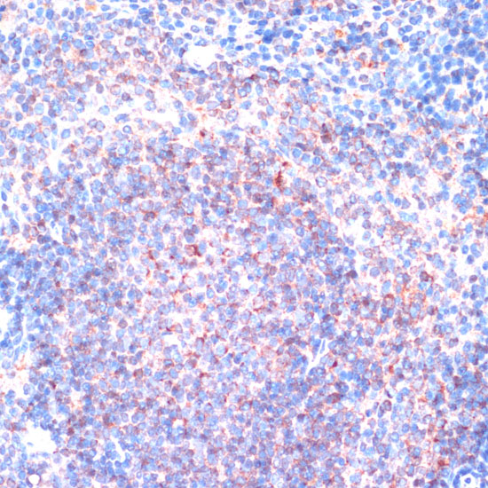 Immunohistochemistry of paraffin-embedded Mouse spleen using P90RSK Polyclonal Antibody at dilution of  1:100 (40x lens).