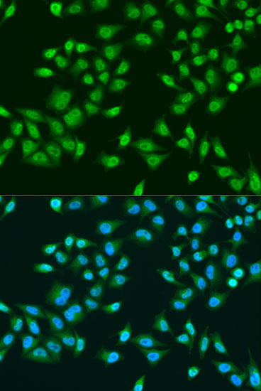 Immunofluorescence analysis of U2OS cells using RPS6KB1 Polyclonal Antibody at dilution of  1:100. Blue: DAPI for nuclear staining.