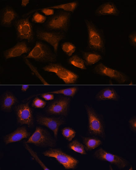 Immunofluorescence analysis of U-2 OS cells using RPS13 Polyclonal Antibody at dilution of  1:100. Blue: DAPI for nuclear staining.