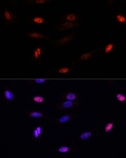 Immunofluorescence analysis of U-2 OS cells using SUMO3 Polyclonal Antibody at dilution of  1:100. Blue: DAPI for nuclear staining.