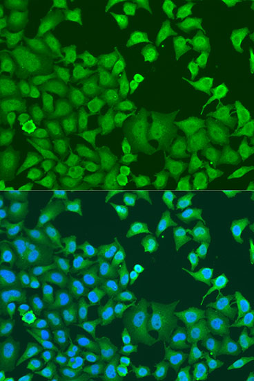 Immunofluorescence analysis of U2OS cells using STAT3 Polyclonal Antibody at dilution of  1:100. Blue: DAPI for nuclear staining.