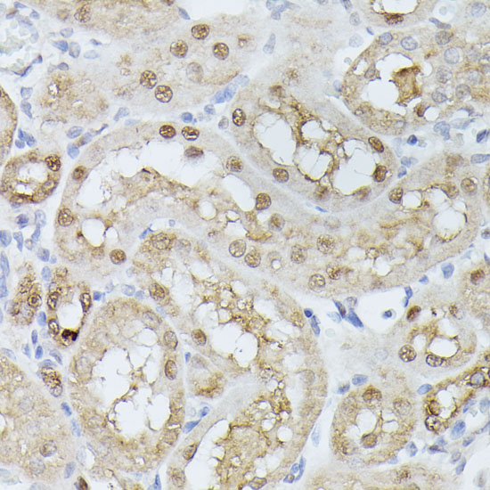 Immunohistochemistry of paraffin-embedded Rat kidney using TPI1 Polyclonal Antibody at dilution of  1:100 (40x lens).