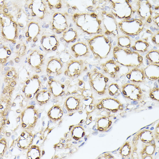Immunohistochemistry of paraffin-embedded Mouse kidney using TPI1 Polyclonal Antibody at dilution of  1:100 (40x lens).