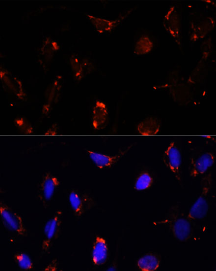 Immunofluorescence analysis of U-2 OS cells using TBRG4 Polyclonal Antibody at dilution of  1:100. Blue: DAPI for nuclear staining.