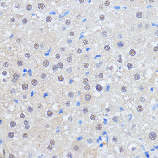 Immunohistochemistry of paraffin-embedded Rat liver using RBM39 Polyclonal Antibody at dilution of  1:100 (40x lens).