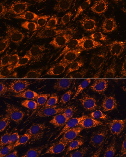Immunofluorescence analysis of C6 cells using ACAA2 Polyclonal Antibody at dilution of  1:100. Blue: DAPI for nuclear staining.