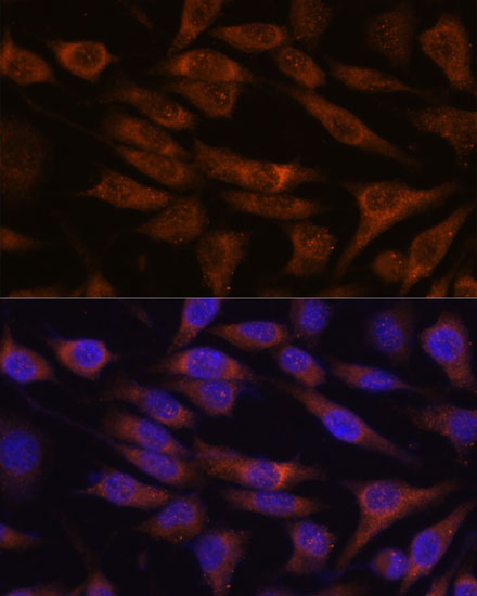Immunofluorescence analysis of L929 cells using UNC13B Polyclonal Antibody at dilution of  1:100. Blue: DAPI for nuclear staining.