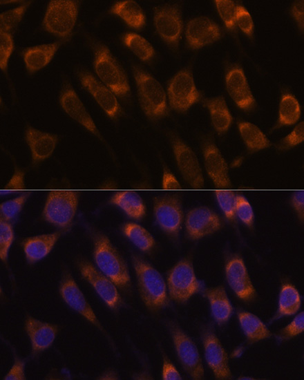 Immunofluorescence analysis of L929 cells using SEC61B Polyclonal Antibody at dilution of  1:100. Blue: DAPI for nuclear staining.