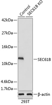 Western blot analysis of extracts from normal (control) and SEC61B knockout (KO) 293T cells using SEC61B Polyclonal Antibody at dilution of 1:1000.