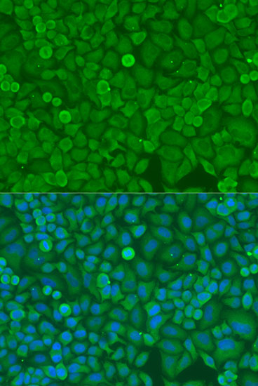 Immunofluorescence analysis of U2OS cells using DICER1 Polyclonal Antibody at dilution of  1:100. Blue: DAPI for nuclear staining.