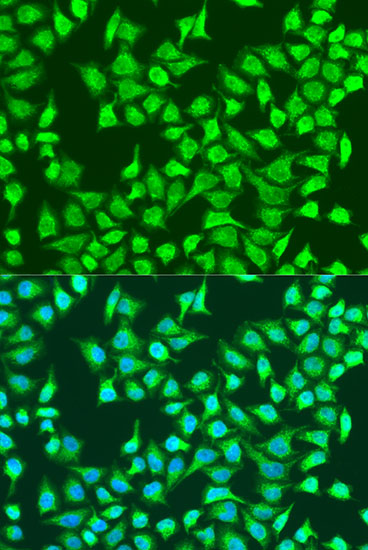 Immunofluorescence analysis of U2OS cells using SIRT4 Polyclonal Antibody at dilution of  1:100. Blue: DAPI for nuclear staining.