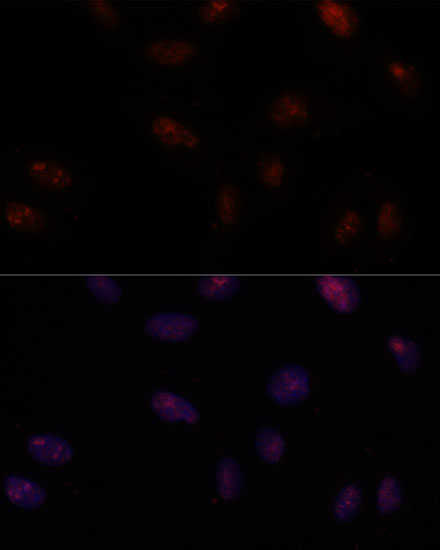 Immunofluorescence analysis of U-2 OS cells using SF3B1 Polyclonal Antibody at dilution of  1:100. Blue: DAPI for nuclear staining.
