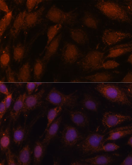 Immunofluorescence analysis of C6 cells using GCAT Polyclonal Antibody at dilution of  1:100. Blue: DAPI for nuclear staining.