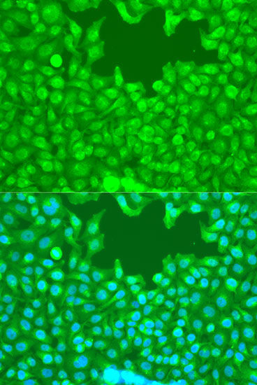 Immunofluorescence analysis of U2OS cells using TAZ Polyclonal Antibody at dilution of  1:100. Blue: DAPI for nuclear staining.