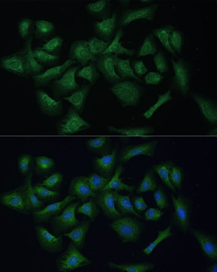 Immunofluorescence analysis of U-2 OS cells using REXO2 Polyclonal Antibody at dilution of  1:100 (40x lens). Blue: DAPI for nuclear staining.