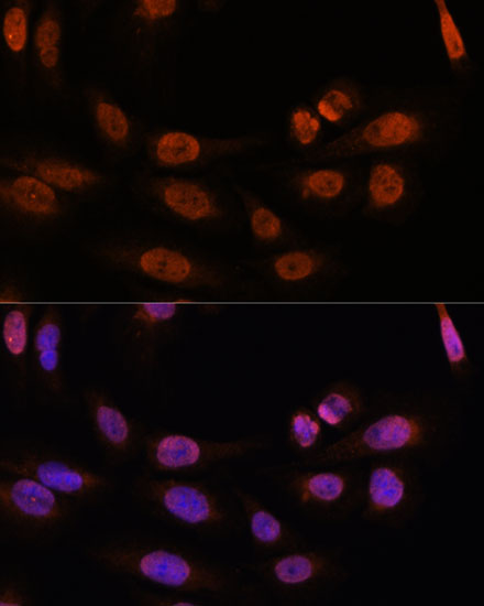 Immunofluorescence analysis of U-2 OS cells using THRB Polyclonal Antibody at dilution of  1:100. Blue: DAPI for nuclear staining.