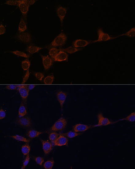 Immunofluorescence analysis of NIH-3T3 cells using PIK3R4 Polyclonal Antibody at dilution of  1:100 (40x lens). Blue: DAPI for nuclear staining.