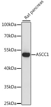 Western blot analysis of extracts of Rat pancreas using ASCC1 Polyclonal Antibody at dilution of 1:1000.