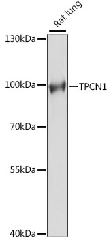 Western blot analysis of extracts of Rat lung using TPCN1 Polyclonal Antibody at dilution of 1:1000.