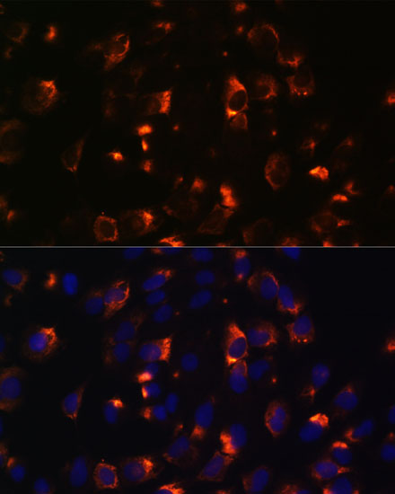 Immunofluorescence analysis of C6 cells using CCDC47 Polyclonal Antibody at dilution of  1:100. Blue: DAPI for nuclear staining.