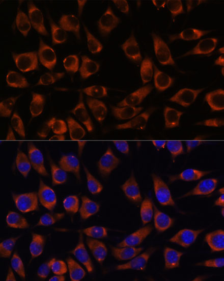 Immunofluorescence analysis of L929 cells using CCDC47 Polyclonal Antibody at dilution of  1:100. Blue: DAPI for nuclear staining.